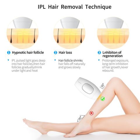 IPL Laser Hair Removal - peelskin